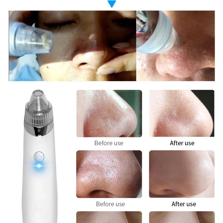 Multifunctional Beauty Pore Vacuum 4 in 1